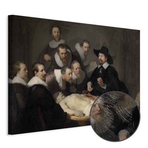 Obraz - Rembrandt - Lekcja anatomii doktora Tulpa 30x20 Premium Print